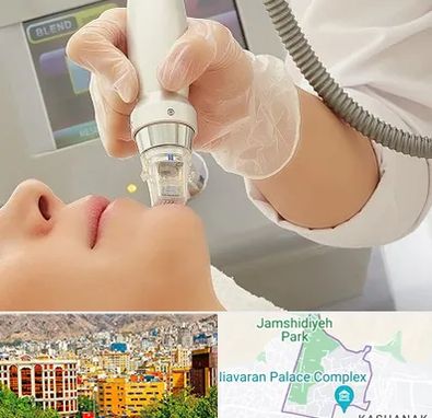 آر اف فرکشنال در نیاوران 