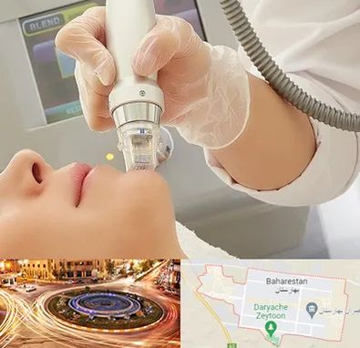 آر اف فرکشنال در بهارستان