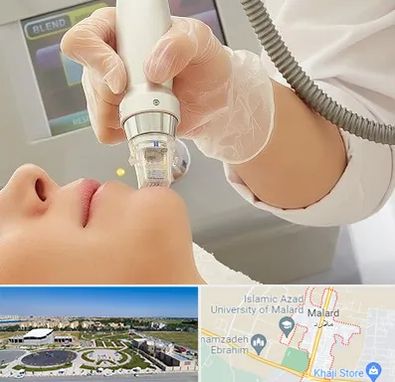 آر اف فرکشنال در ملارد