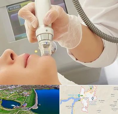 آر اف فرکشنال در مهاباد