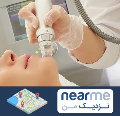 آر اف فرکشنال در نزدیک من