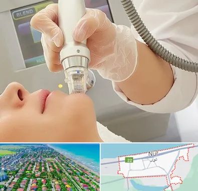 آر اف فرکشنال در نور