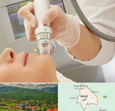 آر اف فرکشنال در آمل