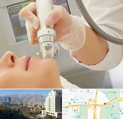 آر اف فرکشنال در حقانی 