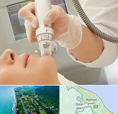 آر اف فرکشنال در رامسر