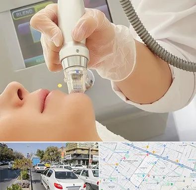 آر اف فرکشنال در مفتح مشهد