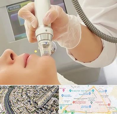 آر اف فرکشنال در شهرک غرب مشهد