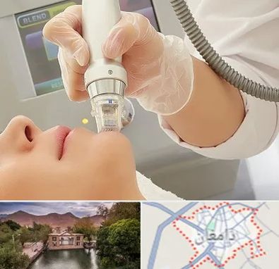 آر اف فرکشنال در دامغان
