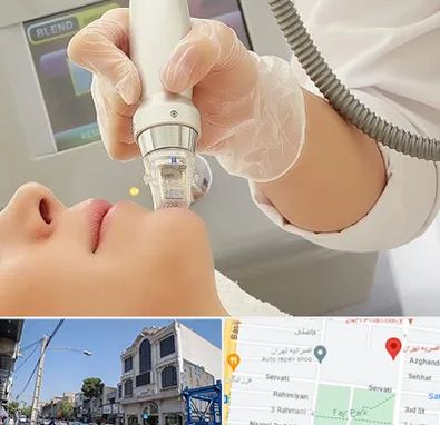 آر اف فرکشنال در افسریه 