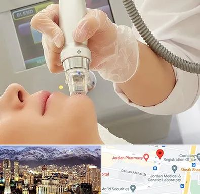 آر اف فرکشنال در جردن 