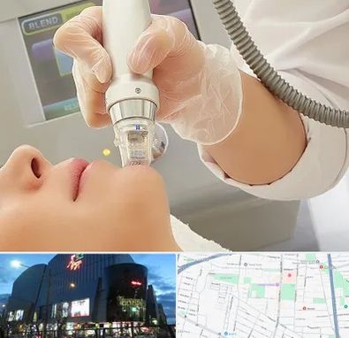 آر اف فرکشنال در بلوار اباذر