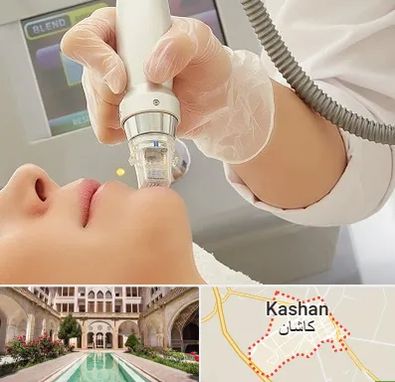 آر اف فرکشنال در کاشان