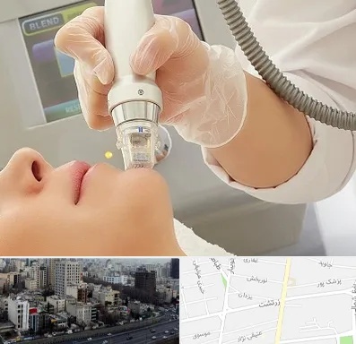 آر اف فرکشنال در زرتشت