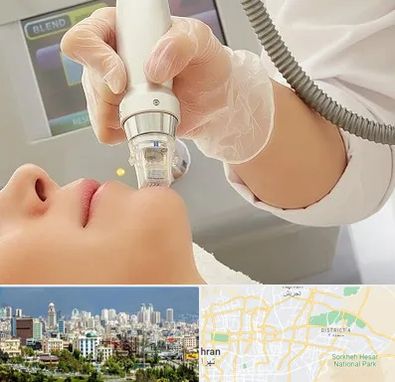 آر اف فرکشنال در شرق تهران 