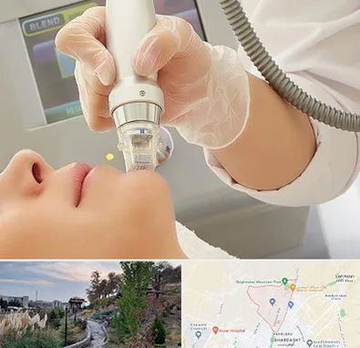 آر اف فرکشنال در باغستان کرج