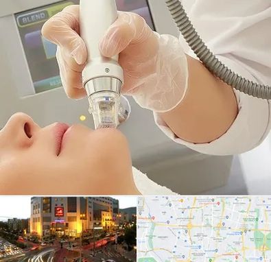 آر اف فرکشنال در جنت آباد تهران 