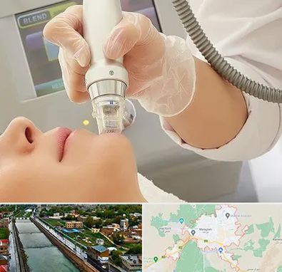 آر اف فرکشنال در مراغه