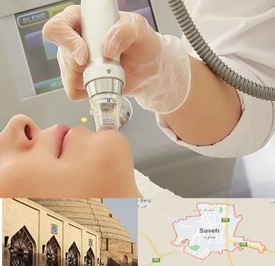 آر اف فرکشنال در ساوه