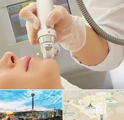 آر اف فرکشنال در تهران