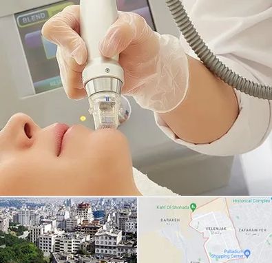 آر اف فرکشنال در ولنجک 