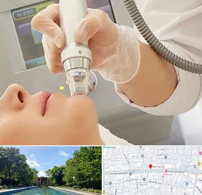 آر اف فرکشنال در هشت بهشت اصفهان