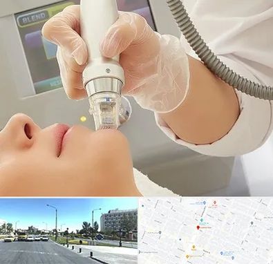 آر اف فرکشنال در بلوار کلاهدوز مشهد 