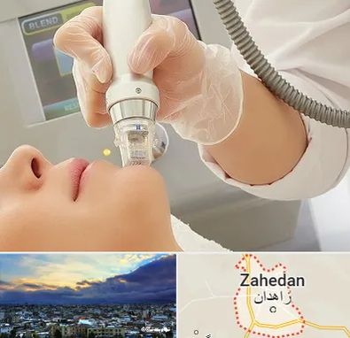 آر اف فرکشنال در زاهدان