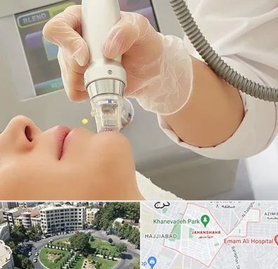 آر اف فرکشنال در جهانشهر کرج 