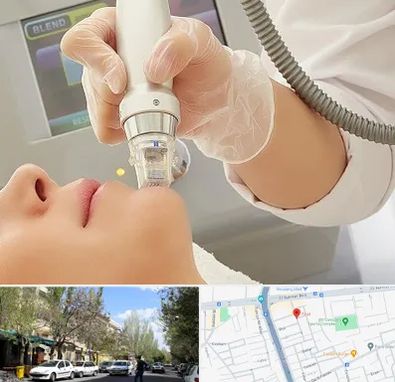 آر اف فرکشنال در کوی فیروز تبریز