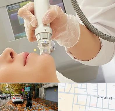 آر اف فرکشنال در خیابان فلسطین