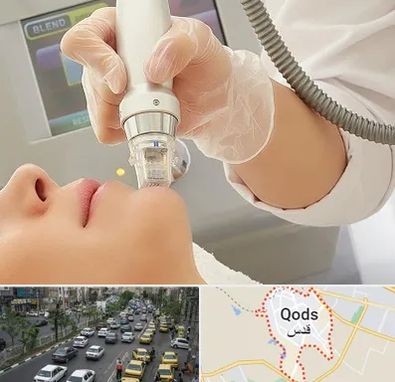 آر اف فرکشنال در شهر قدس