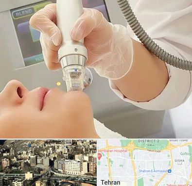 آر اف فرکشنال در مرزداران 