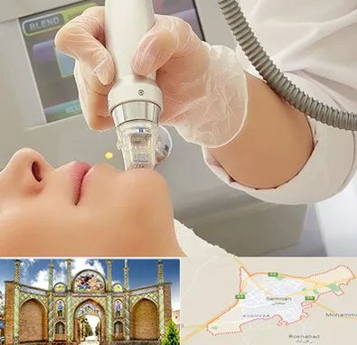 آر اف فرکشنال در سمنان