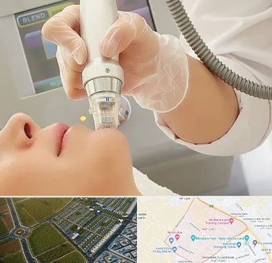 آر اف فرکشنال در الهیه مشهد