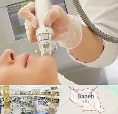 آر اف فرکشنال در بانه