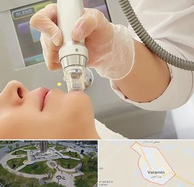 آر اف فرکشنال در ورامین