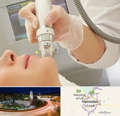 آر اف فرکشنال در همدان