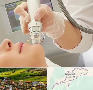 آر اف فرکشنال در کلاردشت