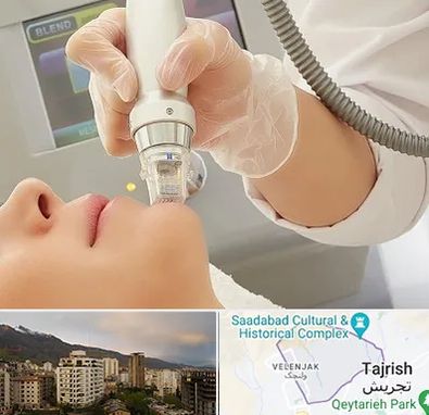 آر اف فرکشنال در زعفرانیه 