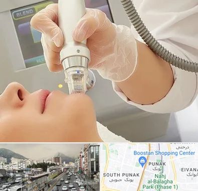 آر اف فرکشنال در پونک 