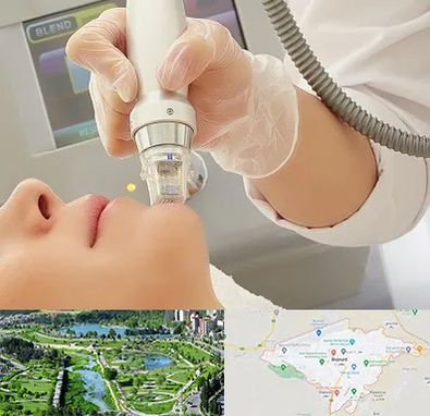 آر اف فرکشنال در بجنورد