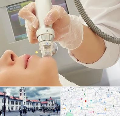 آر اف فرکشنال در میدان شهرداری رشت