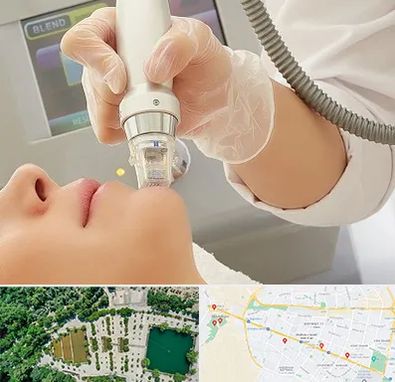 آر اف فرکشنال در وکیل آباد مشهد