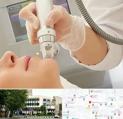 آر اف فرکشنال در طالقانی 