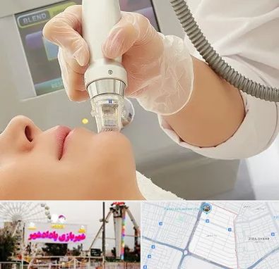 آر اف فرکشنال در پادادشهر اهواز