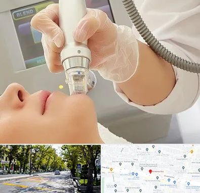 آر اف فرکشنال در میرداماد 