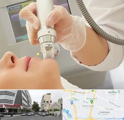 آر اف فرکشنال در بلوار فردوس 