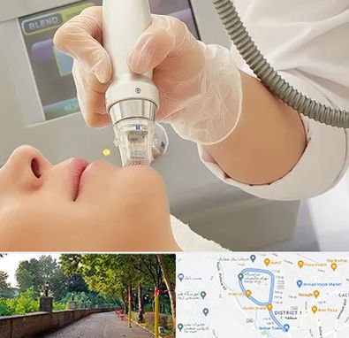 آر اف فرکشنال در بلوار گیلان رشت