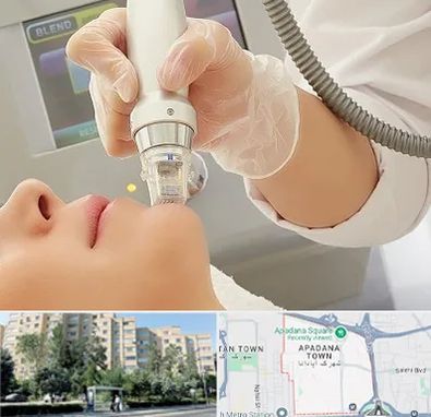 آر اف فرکشنال در آپادانا