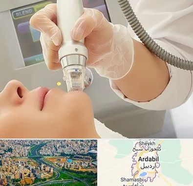 آر اف فرکشنال در اردبیل